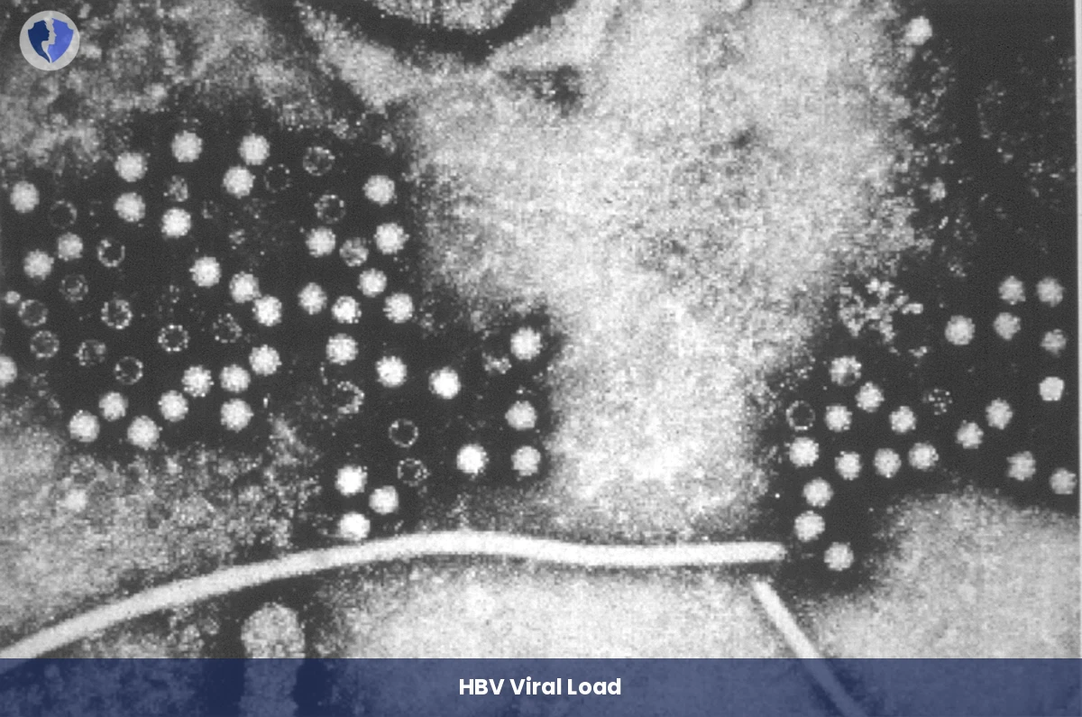 Quantitative Hepatitis B Virus (HBV) DNA PCR Test